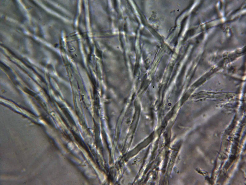 Ceriporia viridans 19 - x 1000 agua